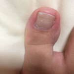 原因はローファー・パンプスの履きすぎだと思う