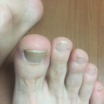 形成外科に行った