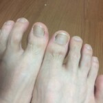 先の細いスパイクで足を圧迫していた