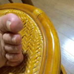 爪の切り方とサイズに合っていない靴を履いていたことが原因と考えられる